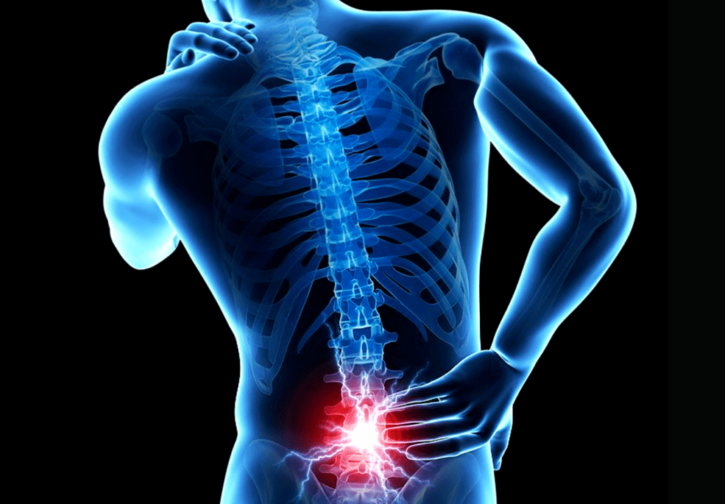 Signs of lumbar osteochondrosis