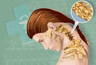 Reflex symptoms of a neck osteochondrosis