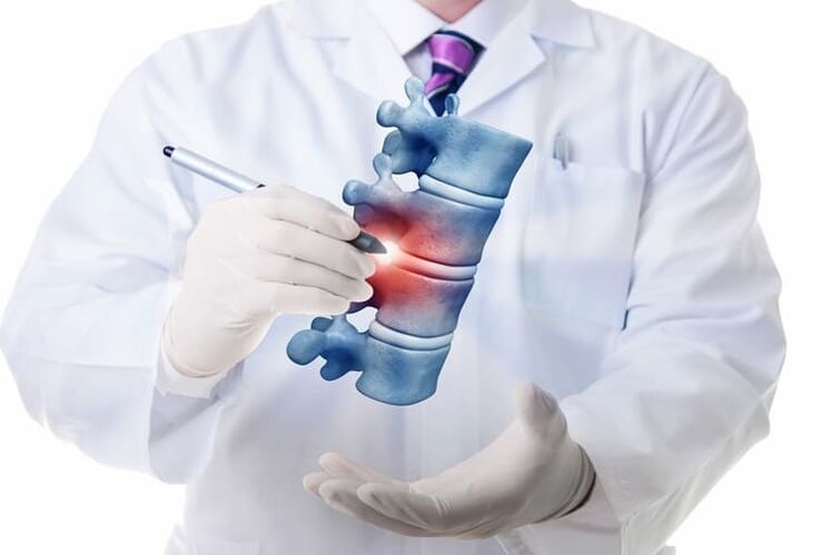 Spinal lesions due to thoracic osteochondrosis