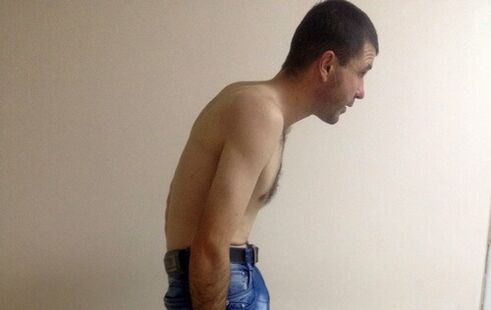 Ankylosing spondylitis can cause lower back pain over the years